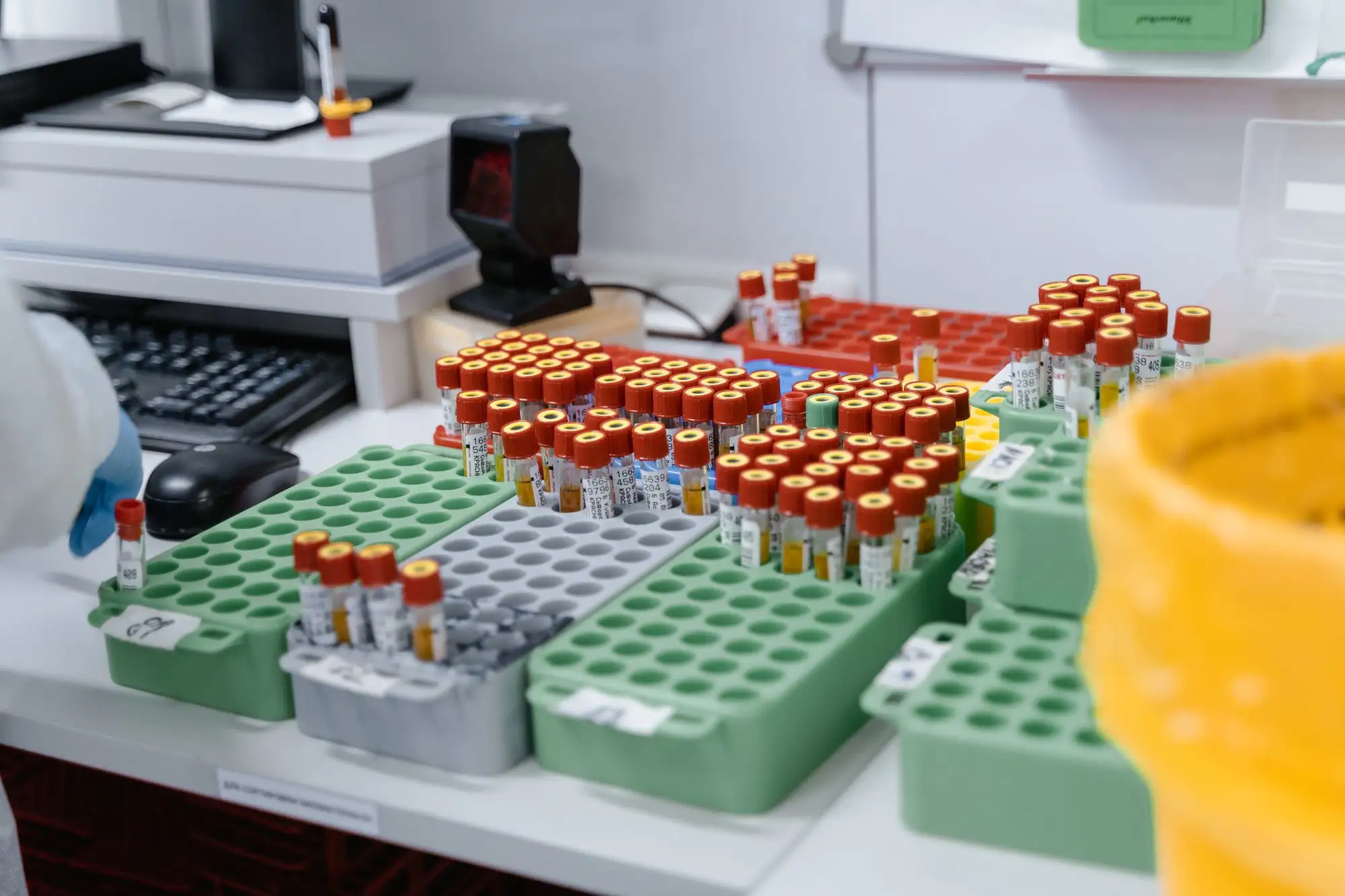 Rows of blood sample tubes wait in trays in a laboratory.